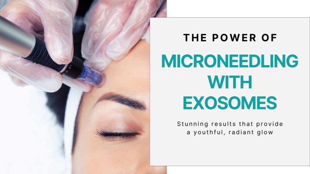 microneedling in newport beach CA