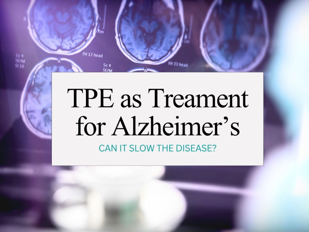 Alzheimer's treatment